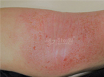 피부를 피부답게 생기 네트워크의 실제 임상 데이터 기반 피부질환 집중연구